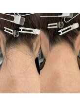 ベリンダ ワックス(BELINDA WAX)/うなじワックス