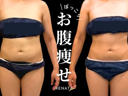 レナータ 大宮店(RENATA)の写真