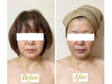 サロンミッシェル(Salon Michel)/背中付き小顔造形フェイシャル