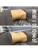 リア(Lia)/40代女性初めての腸ケア