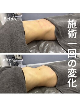 リア(Lia)/40代女性初めての腸ケア