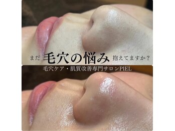 ピエル 柏店(PIEL)の写真/【いちご鼻卒業！】毛穴の角栓、つい自分で押し出していませんか？