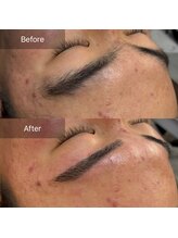 ニューミー(NEW ME)/加古川メンズ眉毛/眉毛デザイン