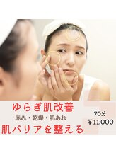 ミモザ(mimosa)/ゆらぎ肌改善◎肌バリアを整える