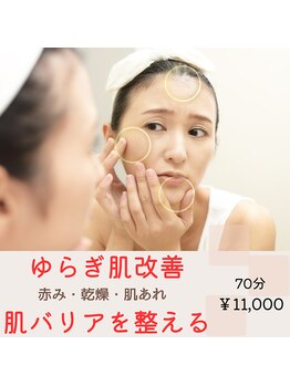 ミモザ(mimosa)/ゆらぎ肌改善◎肌バリアを整える