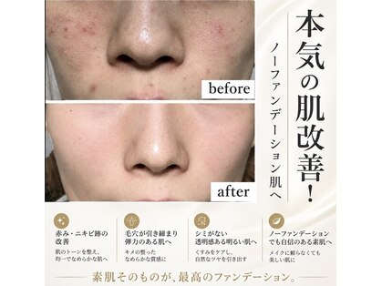 アトレの写真