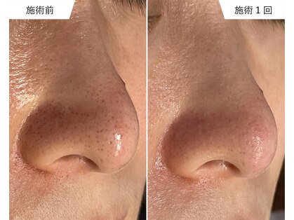 ビューティーサロンエイト(Beauty Salon8)の写真