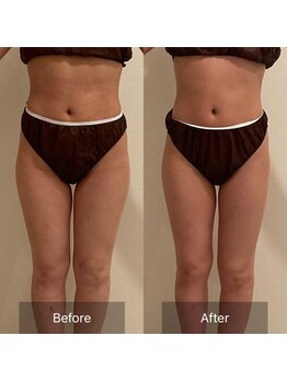 デッサン(dessin)/横に張り出した腿もスッキリ!