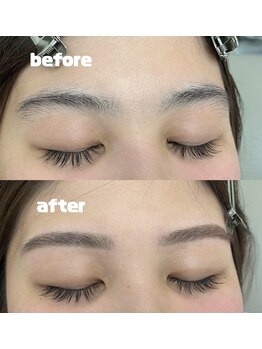 ヒース(Heath)/before&after