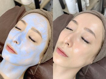 スリースリー(THREE THREE)の写真/【シミ改善◎白玉フェイシャル￥11000~】肌の透明感UP『水光ピ-リング』or芸能人も愛用『クリスティ-ナ』