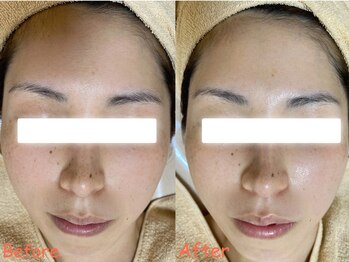 サロンドフルール/ラミネーションピールの施術後