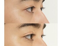 トップ ブロウ オム(TOP BROW HOMME)/上下まつパで目力アップ 天王寺