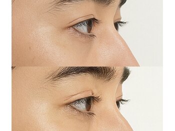 トップ ブロウ オム(TOP BROW HOMME)/上下まつパで目力アップ 天王寺