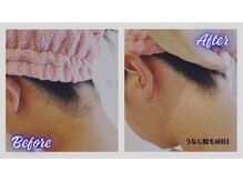 リボーン(Re bone)/全身脱毛がお得♪　