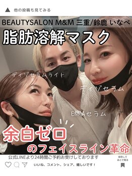 エムアンドエム(M&M)/