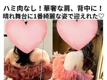 ヨサパーク ルアナ 高島店(YOSA PARK Luana)/ルルオンに出会って良かった！