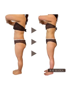 米香(MAIKA)/-7キロ/40代/12回