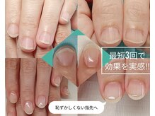 3回目で違いが分かる自爪育成ジェル☆必ず感動させてみせます！