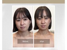 ローズボディ 恵比寿店