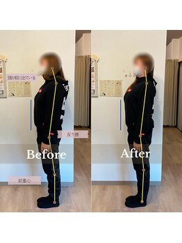 メイリリー(may lily)/◇施術イメージ　30代女性◇