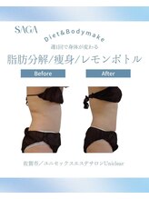 ユニクリア(Uni clear)/ダイエット◆痩身エステ