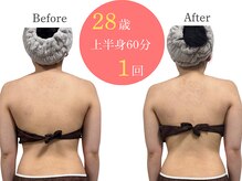 アルピナ(ALPINA)/ウルトランスフォーマー