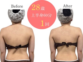 アルピナ(ALPINA)/ウルトランスフォーマー