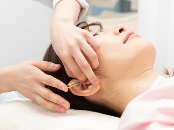 ブレア 元町/耳の鍼