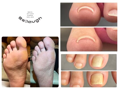 リラフ(Re:laugh)の写真