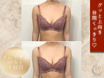 ヴェルナ(VELUNA)の写真/もっと早く来ればよかったの声続出☆バストアップするならVELUNA☆圧倒的なバストアップ専門店の衝撃体験♪