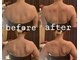 トータルビューティーサロン ビジュ(BIJU)の写真