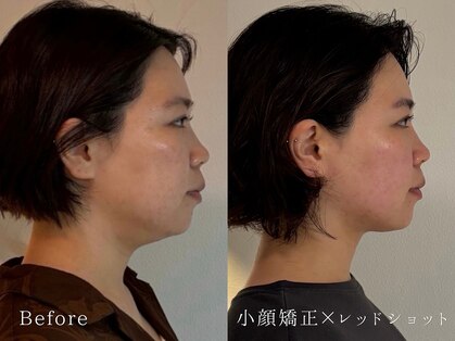 ジョンミー(JONMEE)の写真