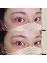 ビスチェ(VISCHE)/まつ毛パーマ