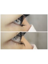 リリアン アイラッシュ(Liliane eyelash)/下まつ毛パーマで逆睫毛改善！