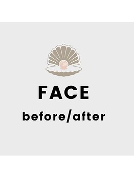 カレン(KAREN)/フェイシャル#透明感#リフト