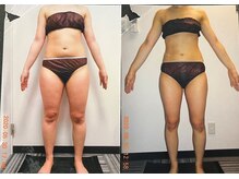 【61.4kg→53.7kg】脚やお腹のむくみにお悩みの方の成功事例をご紹介◎