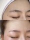 エリス(ELISSE)の写真/【美顔完全コース￥20000】面倒な産毛処理にさようなら♪脱毛でツルスベ肌をGETしスッピン美人へ☆
