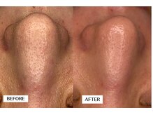 エングラッシー(en glassy)/BEFORE　AFTER　30代