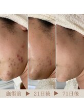 シェノン 赤坂大濠店/