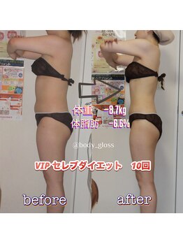ボディグロス 梅田店(BODY GLOSS)/VIPセレブ10回ー8.7kg