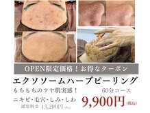 ネーム(Nemu)