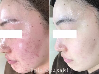 エピア 岡崎店(Epia)の写真