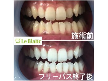 ルブラン 奈良店(Le Blanc)/あっという間の3週間！！