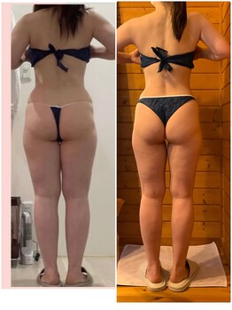 ソル(SOL)/お客様の変化記録