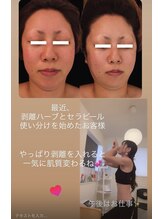 ジーニー(Genie)/キレイになっちゃお
