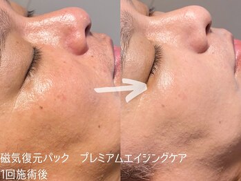 ルーナジェーナ(Luna llena)/男性もスキンケアをする時代