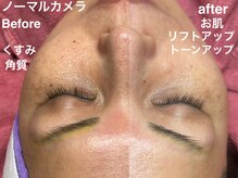 コモドアイラッシュ(comodo eyelash)の雰囲気（【マリムーブフェイシャルワックス正規店】モチモチ艶々卵肌☆）