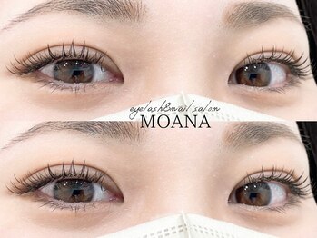 アイラッシュサロンモアナ 梅田芝田店(MOANA)/LEDエクステ120本
