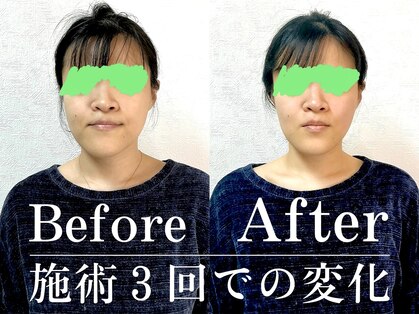 グレイ(GRAY)の写真