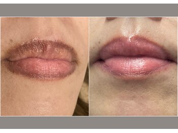 コア チャーム(CORE CHARM)/ローマピンク～リップ～